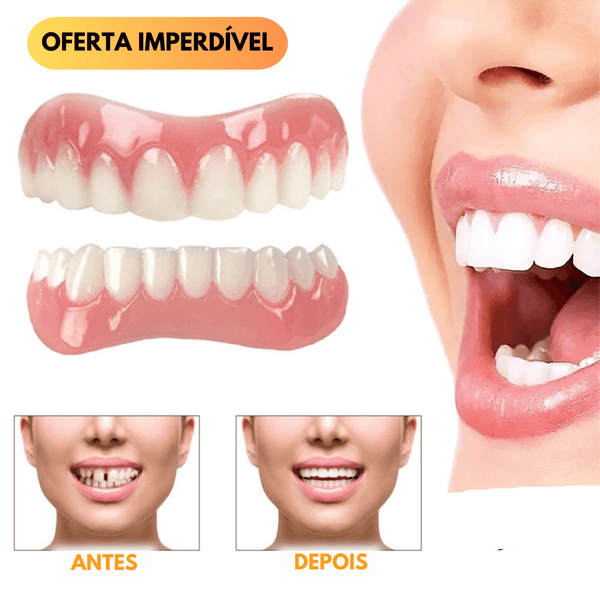 Dentadura Universal NewSmile - FRETE GRÁTIS - Mega Store